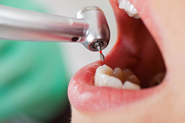 Best Emergency Tooth Extraction in Brookland, AR